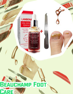 Foot care nail fungus treatment