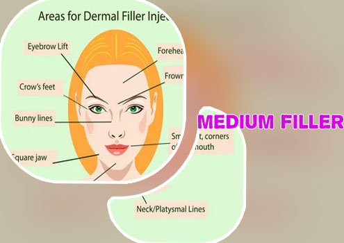 Injectable fillers near me