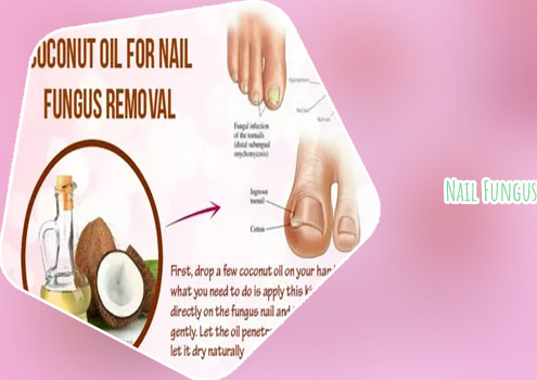 Nail fungus removal