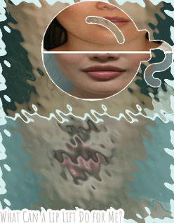 Upper lip lift surgery near me